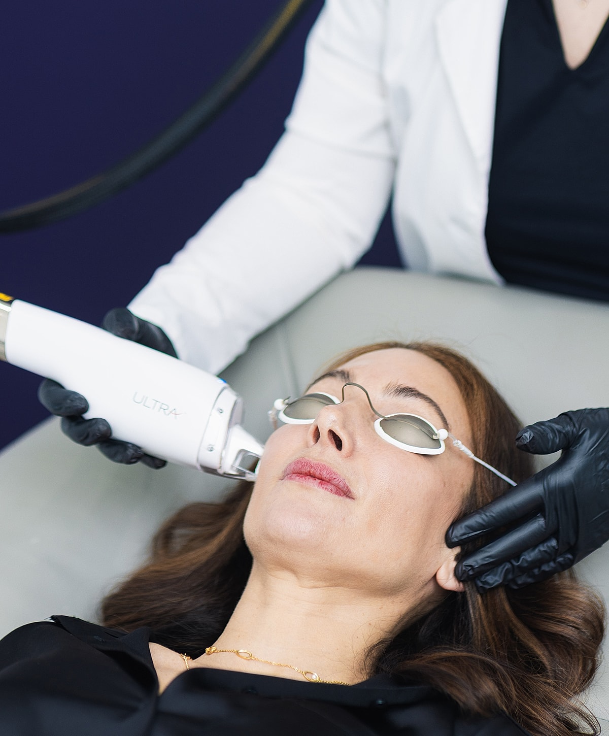 Laser treatment session for facial rejuvenation.