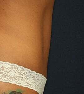 Tummy Tuck Before & After