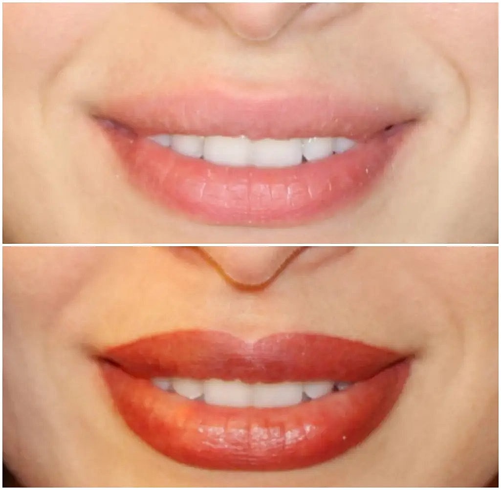 Before And After lip tattooing