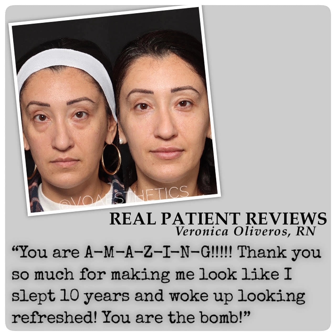 Plastic Surgery Testimonials
