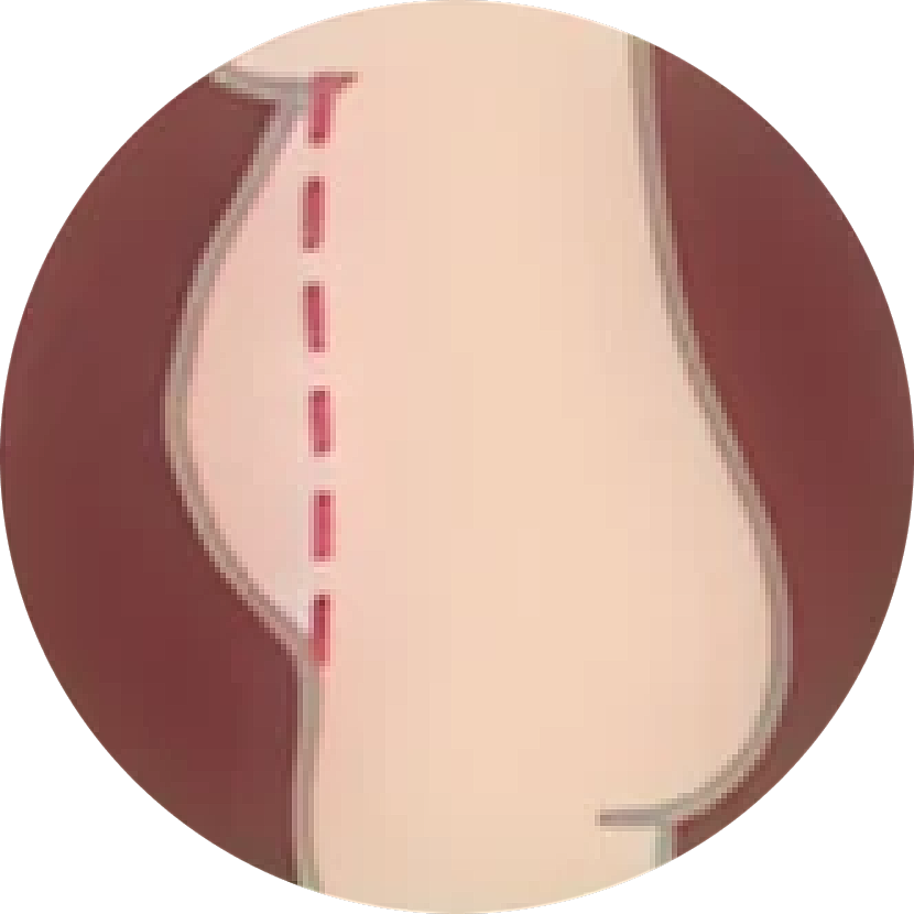 Side view of a simplified body outline.