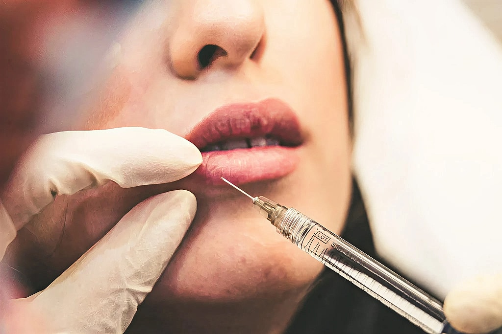 Lip augmentation procedure with injection.