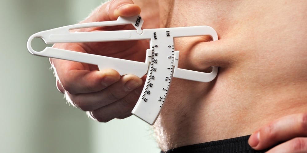 liposuction weight loss 3
