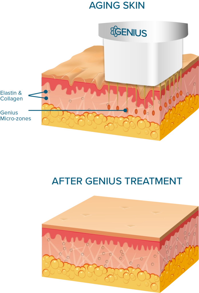 THE SMARTER WAY TO REJUVENATE AGING SKIN